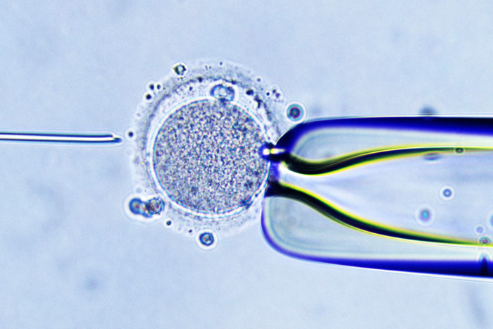 Important information about IVF